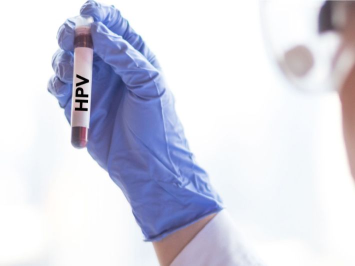 20,000 women to be screened for HPV in Mongolia this year